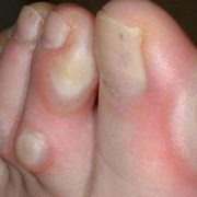 podóloga no batistini, podologia no batistini, podologa em sbc, podologia em sbc, podologia sbc, podologa sbc