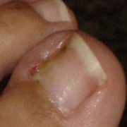 podóloga no batistini, podologia no batistini, podologa em sbc, podologia em sbc, podologia sbc, podologa sbc