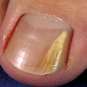 podóloga no batistini, podologia no batistini, podologa em sbc, podologia em sbc, podologia sbc, podologa sbc