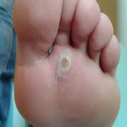 podóloga no batistini, podologia no batistini, podologa em sbc, podologia em sbc, podologia sbc, podologa sbc