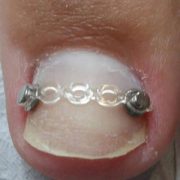 podóloga no batistini, podologia no batistini, podologa em sbc, podologia em sbc, podologia sbc, podologa sbc