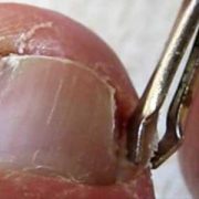 podóloga no batistini, podologia no batistini, podologa em sbc, podologia em sbc, podologia sbc, podologa sbc